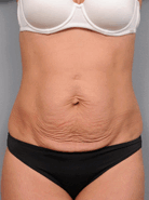Maëlys Belly Firming Cream May Smooth Out Your Figure